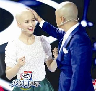 可爱可亲加盟光头美女 <em>没头发</em>一样美貌靓丽_