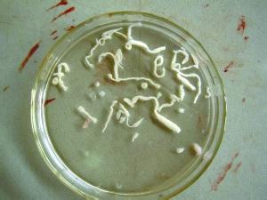 男子脑中取出14厘米裂头蚴寄生虫 疑因常喝生