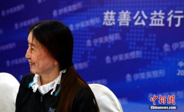 女子分娩后患获得性皮肤松弛症一夜变老 与夫