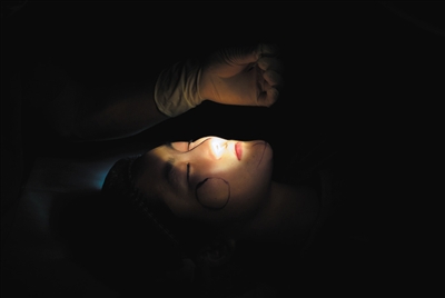 江苏:女子爱美借钱整容 不还钱被毁容