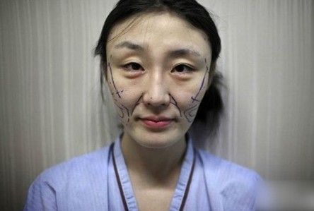 江苏:女子爱美借钱整容 不还钱被毁容