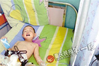 <em>女童</em>陪爷爷遇车祸 右半骨盆区及<em>会阴部</em>毁损伤
