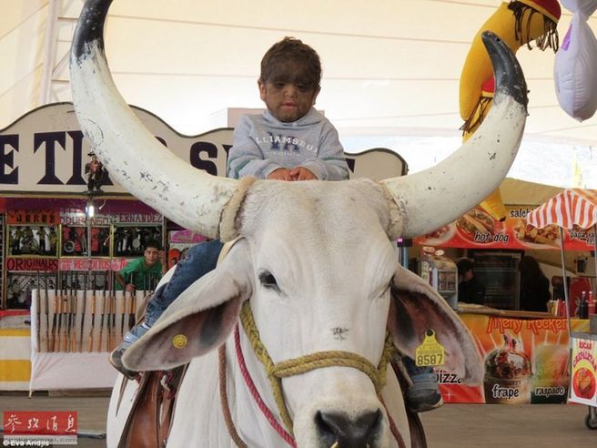 墨西哥一家患多毛症 30人满脸黑发