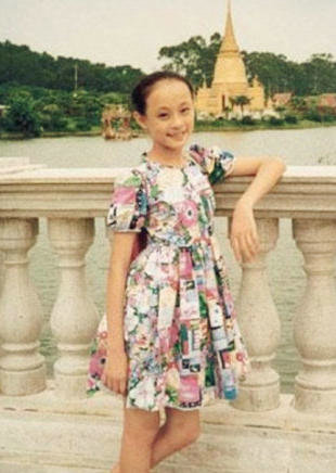 芈月孙俪唇痣车祸造成 揭秘明星如何保持好身