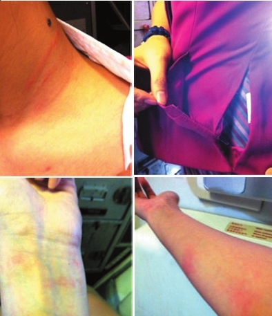 <em>广州</em>一<em>区委</em>常委殴打<em>空姐</em> 有多处挠痕衣服被撕