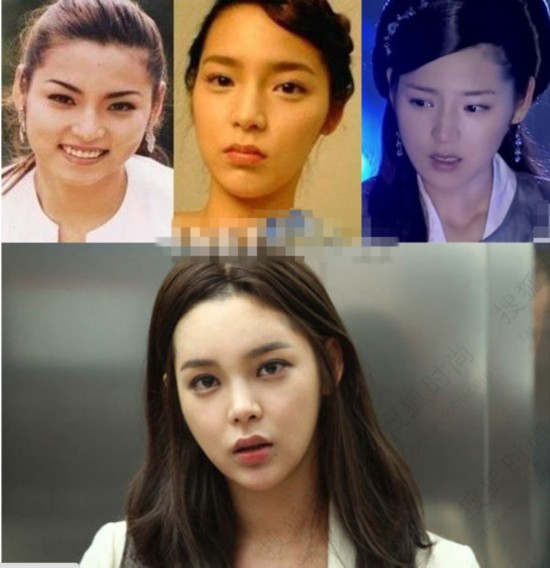 揭韩国娱乐圈整容内幕 肿脸全智贤变女神